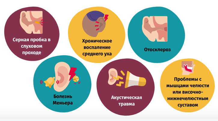 Причины возникновения тиннитуса