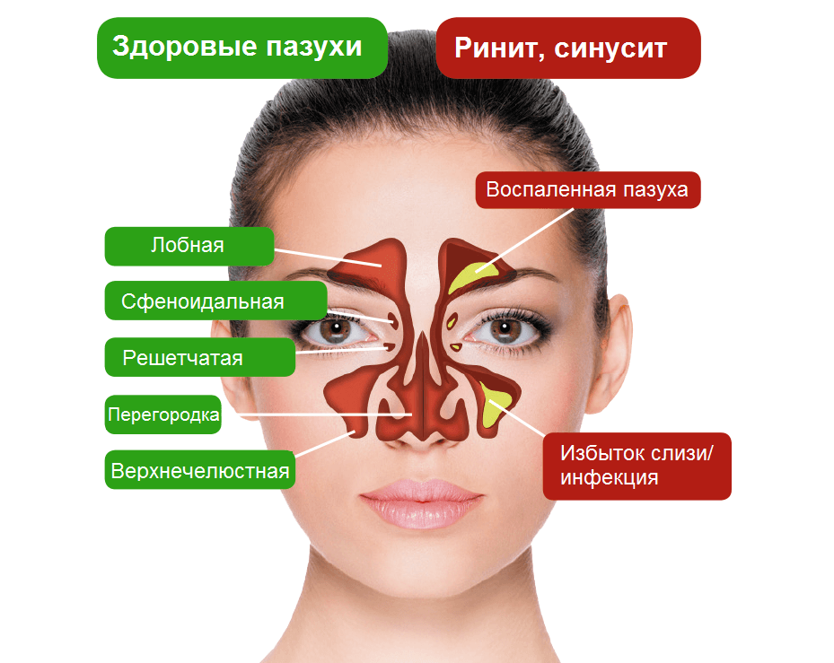 Здоровый нос и заболевания